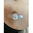 Steril Silikon Tek kullanımlık Endotracheal Tüp Düğme Gastrostomi Yetişkinler İçin